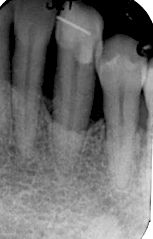 fig. 5l