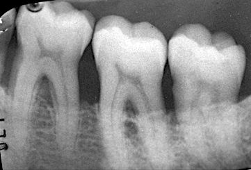 fig. 5n