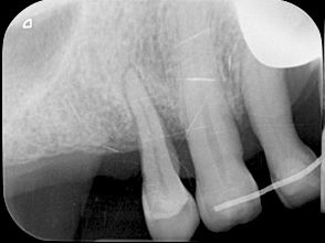 fig. 9a