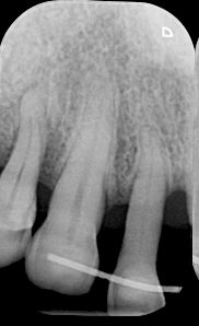 fig. 9b
