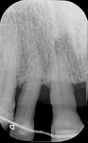 fig. 9c