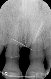 fig. 9d