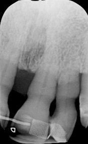 fig. 9e