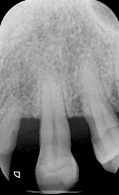 fig. 9f