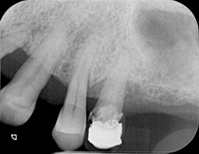 fig. 9g