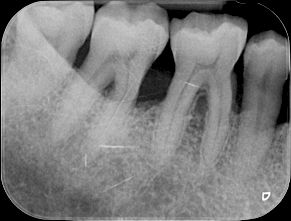 fig. 9h