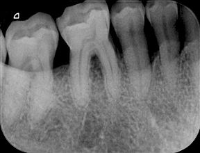 fig. 9i