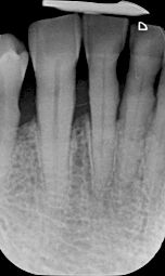 fig. 9j