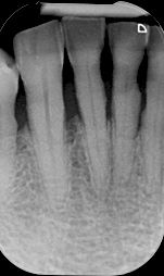 fig. 9k