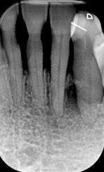 fig. 9l