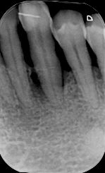 fig. 9m