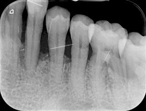 fig. 9n