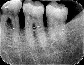 fig. 9o