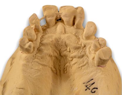 fig. 13a