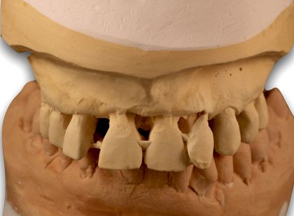 fig. 13b
