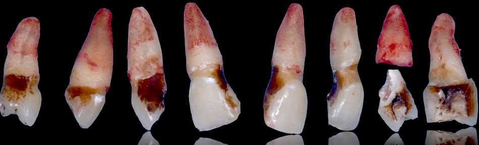 fig. 14b