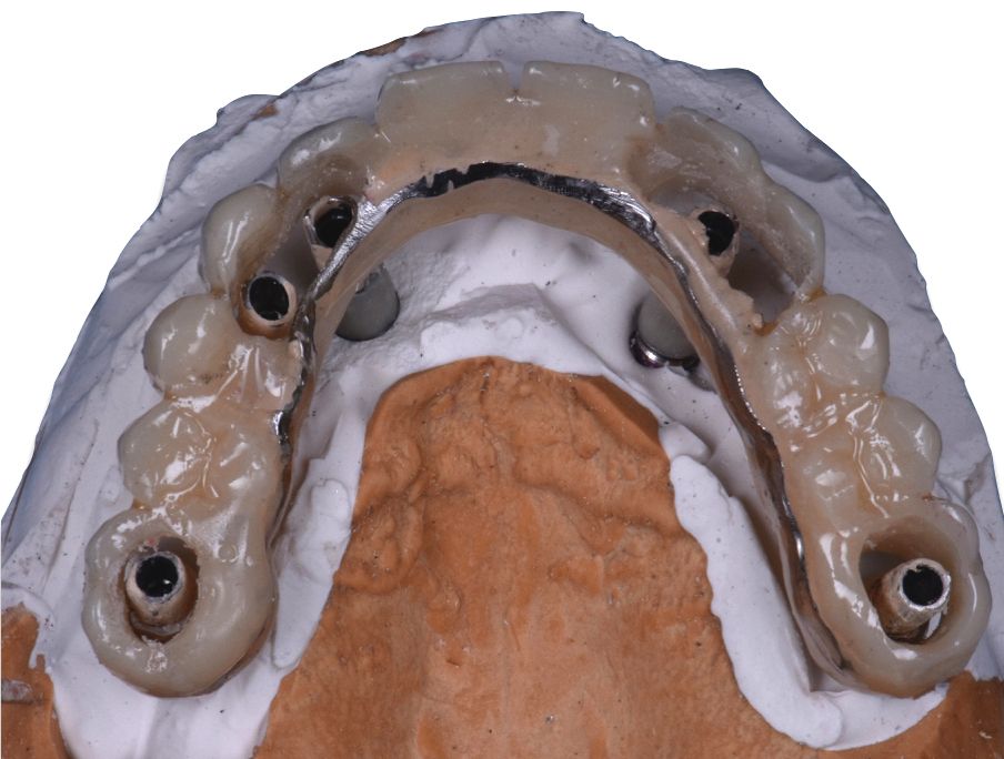 fig. 23b