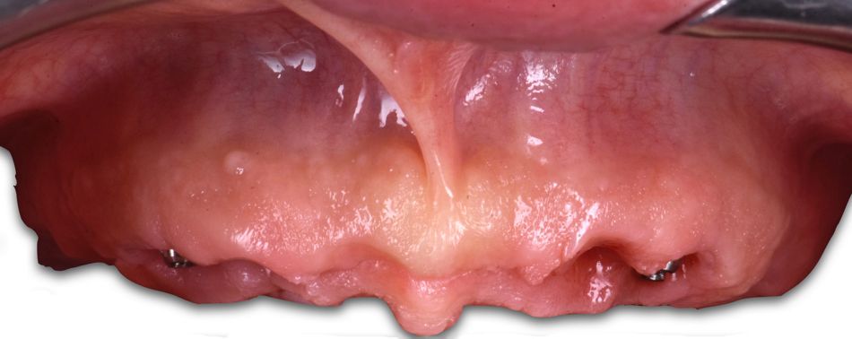 fig. 29a