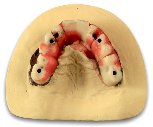 fig. 31a