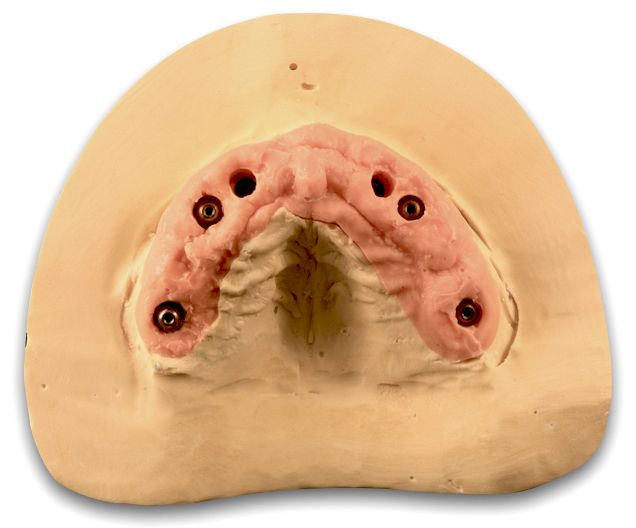 fig. 31b