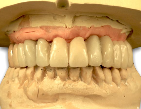 fig. 31c