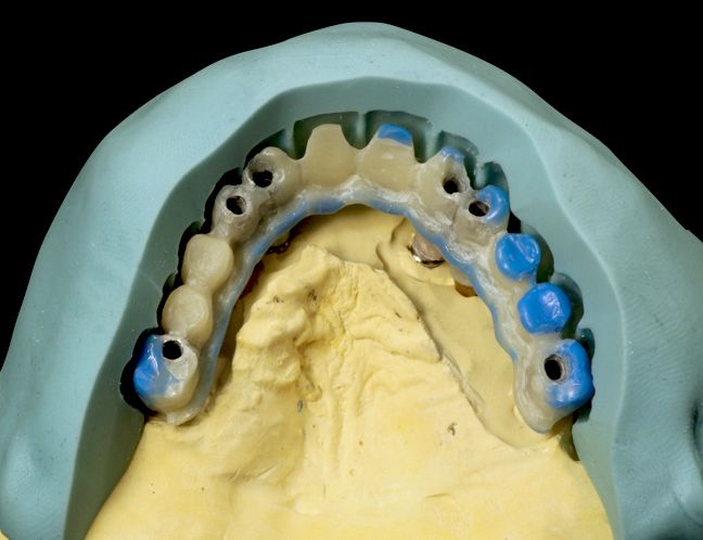 fig. 32a
