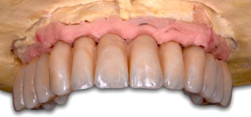 fig. 35a