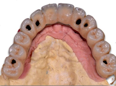 fig. 35b