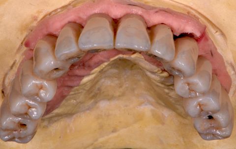 fig. 35c