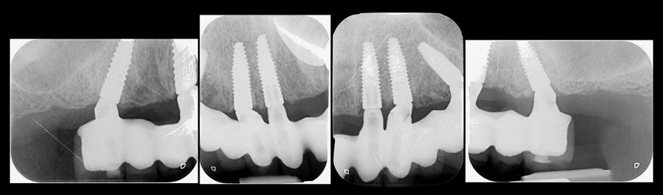 fig. 39