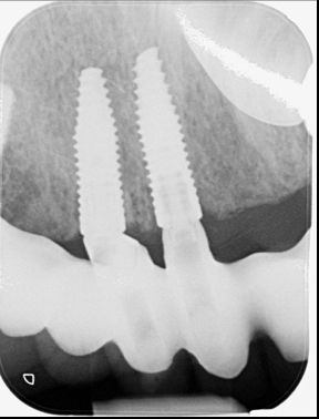fig. 39b