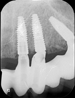 fig. 39c