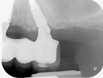 fig. 39d
