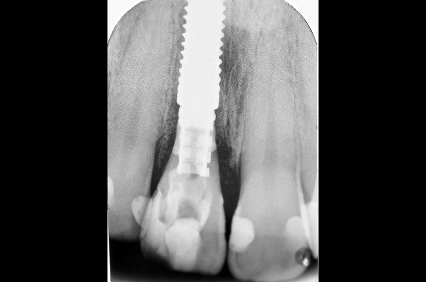 fig. 12