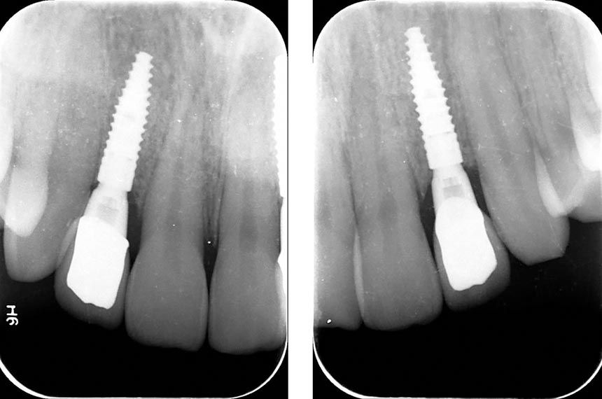 fig. 27