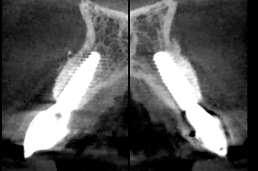 fig. 28