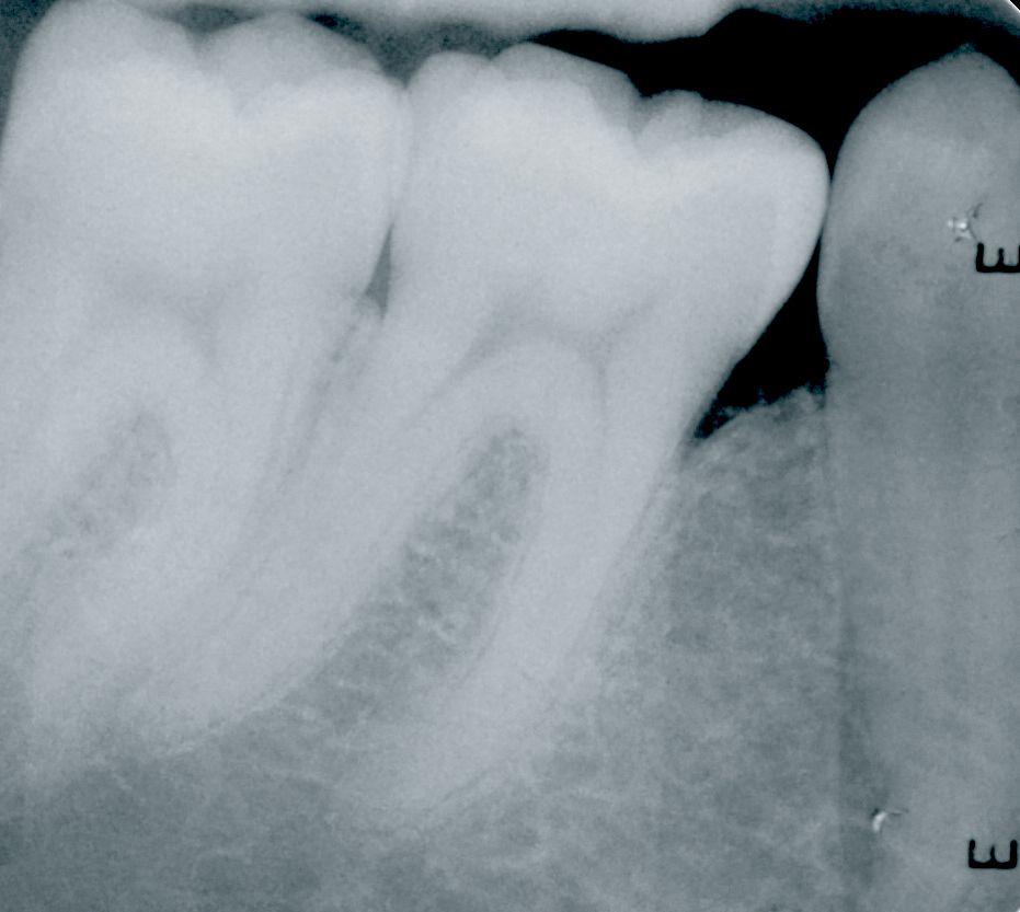 fig. 9