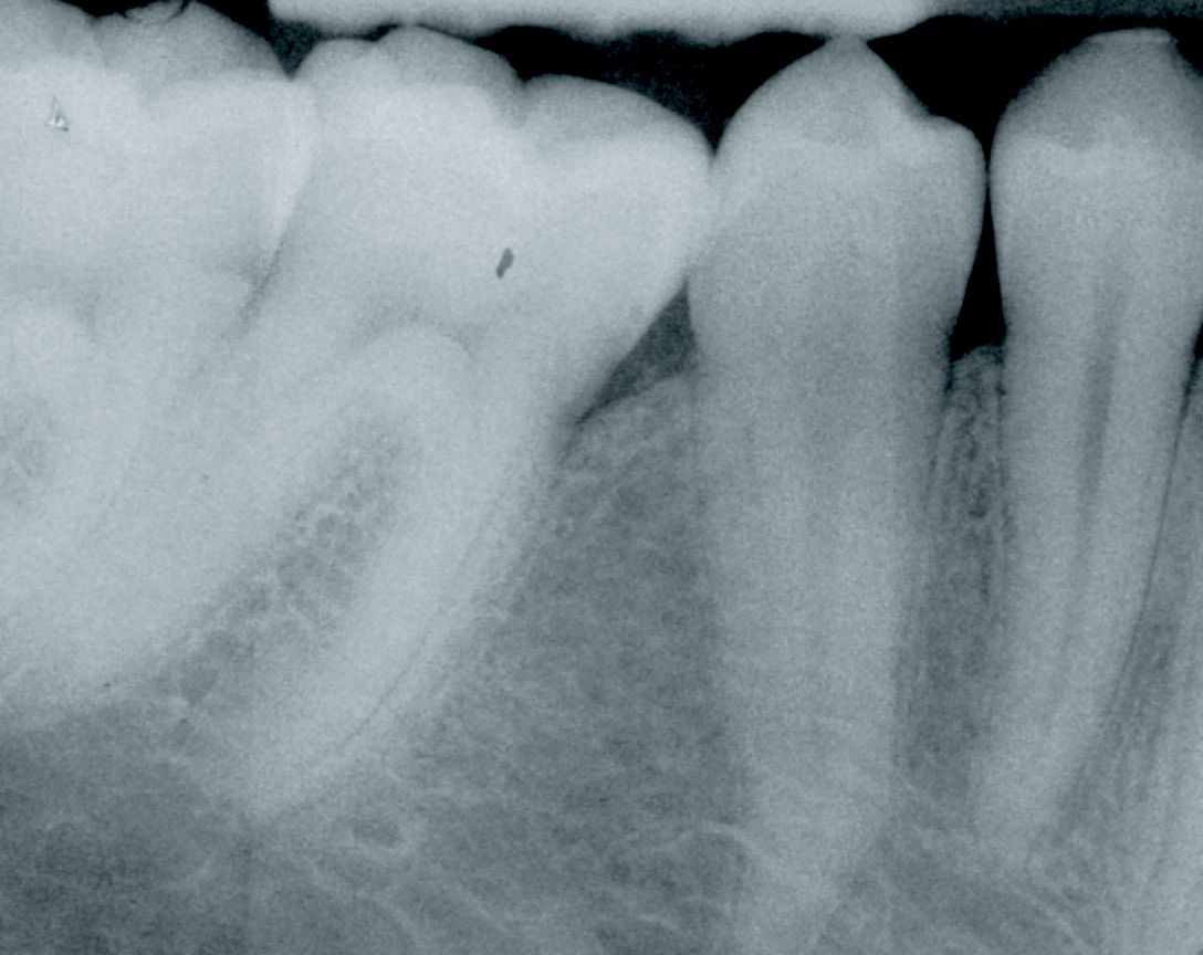 fig. 11