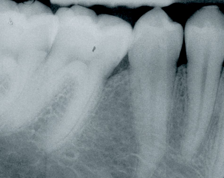 fig. 11