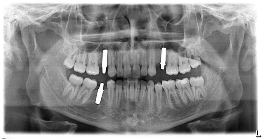 fig. 10