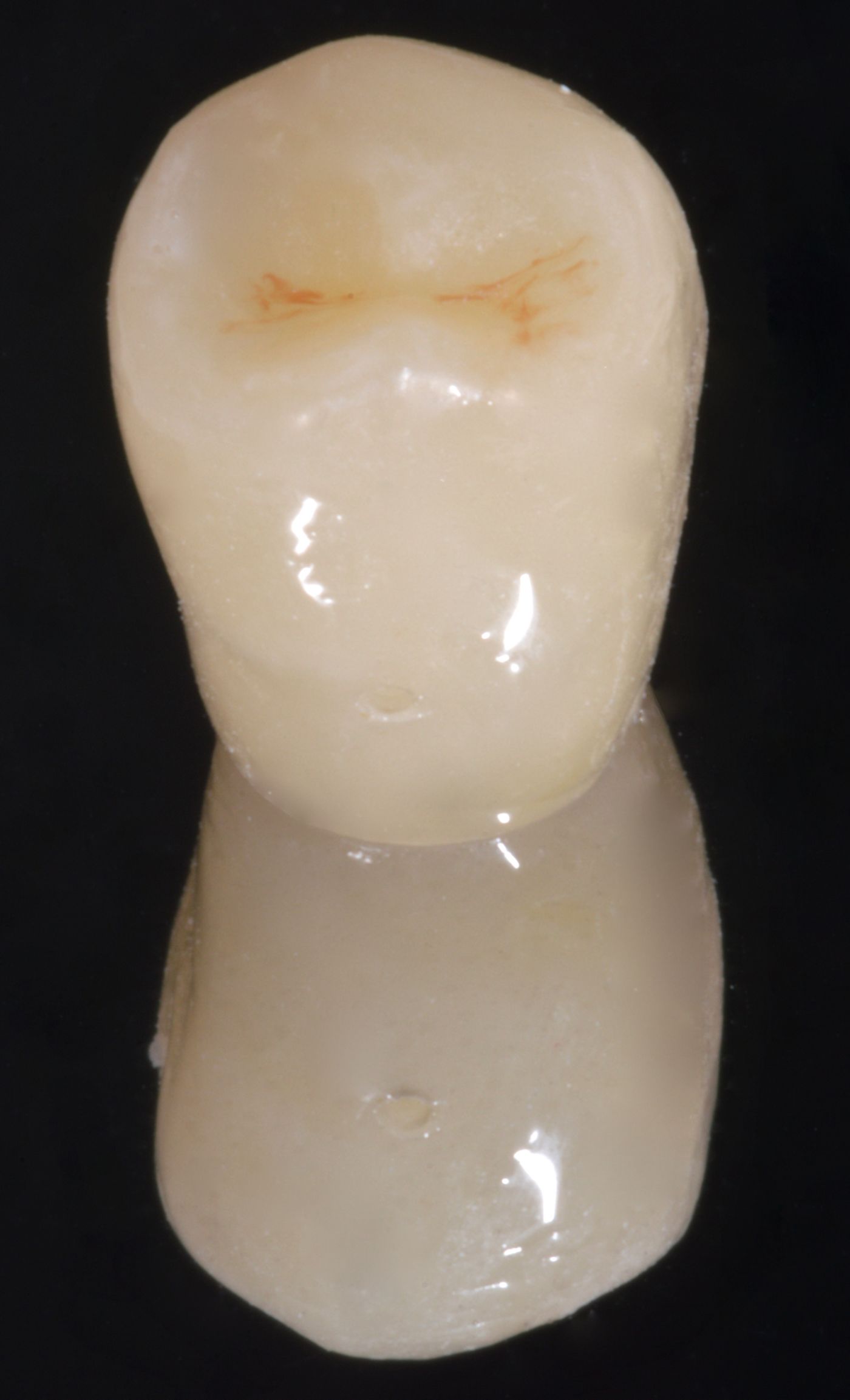 pandolfi_20_pure