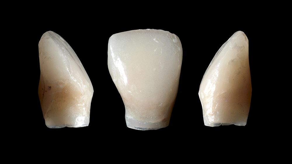 fig. 11