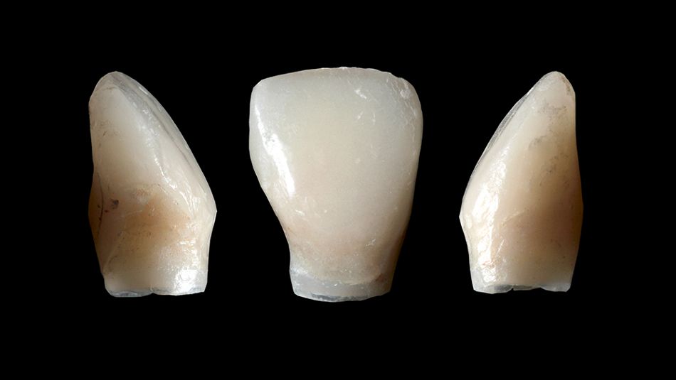 fig. 11