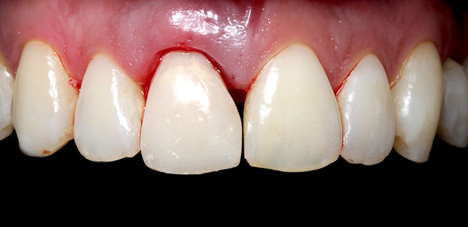 fig. 12