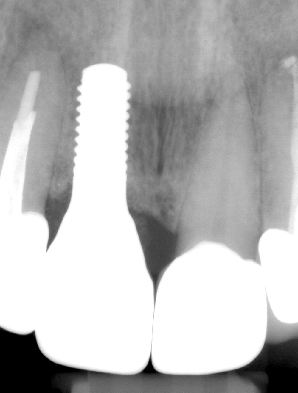 fig. 17