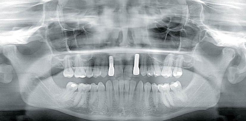 fig. 9