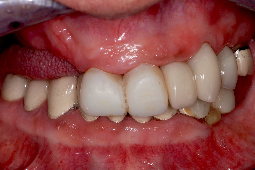 fig.2