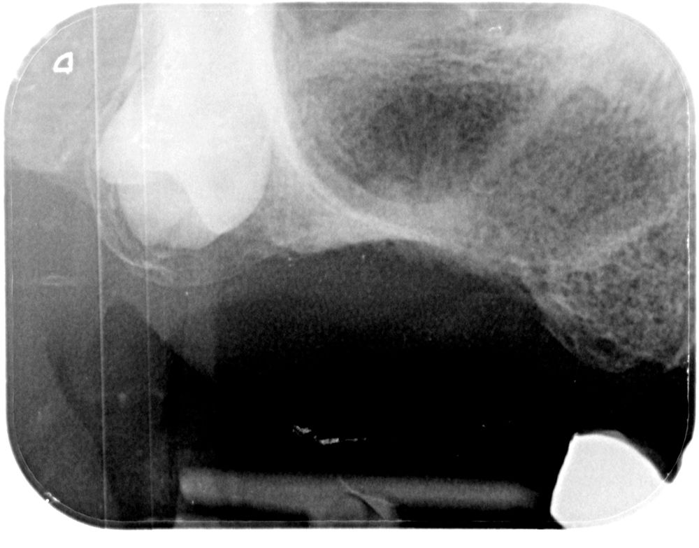 fig.4