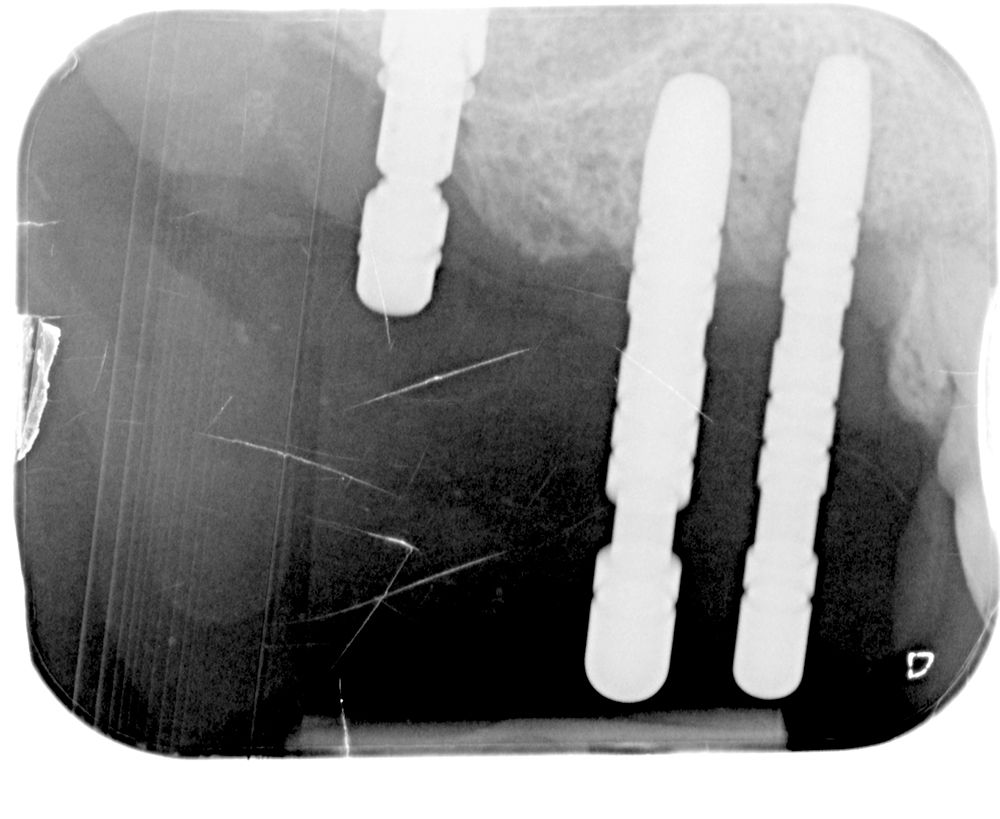 fig. 9