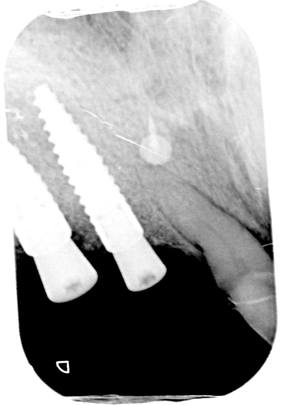 fig. 18
